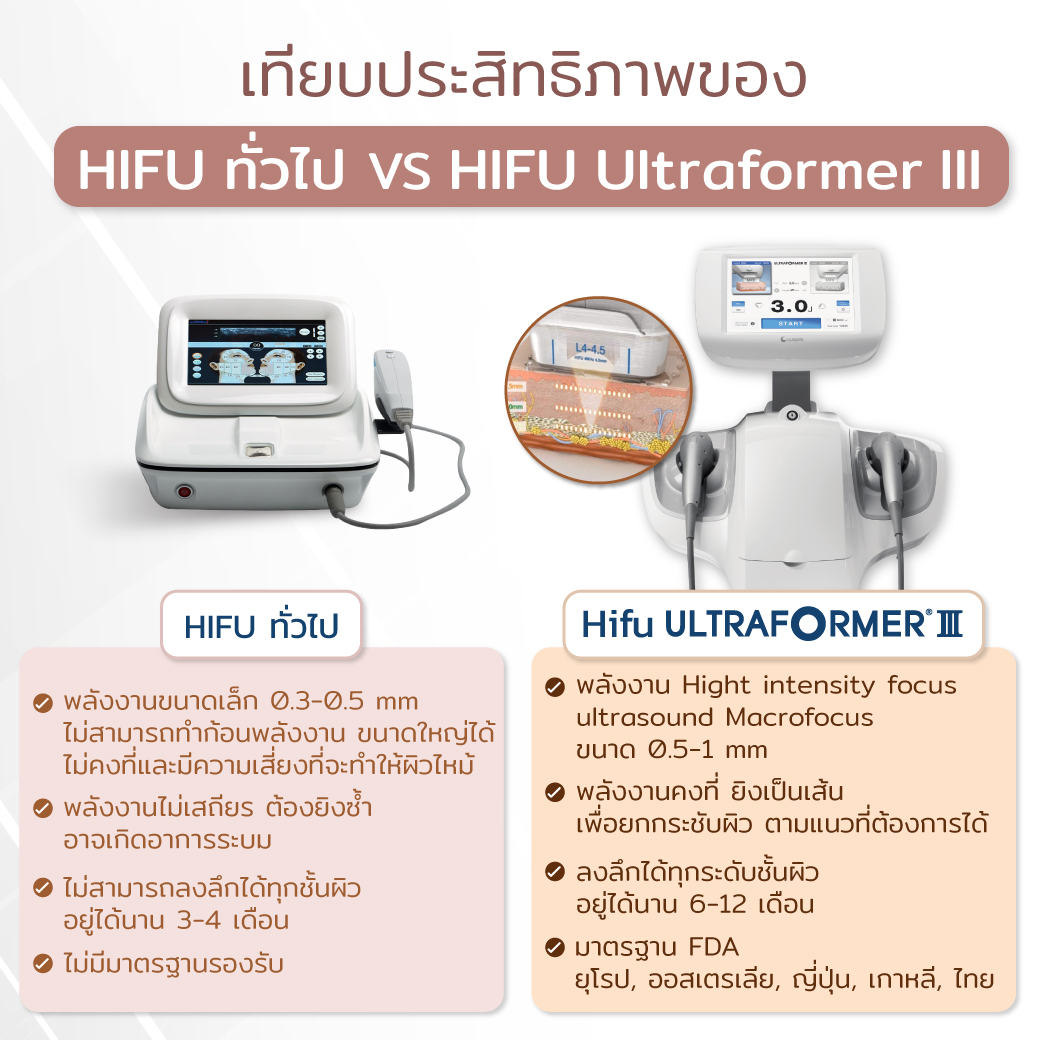 Hifu Ultraformer III กับ Hifu ทั่วไป