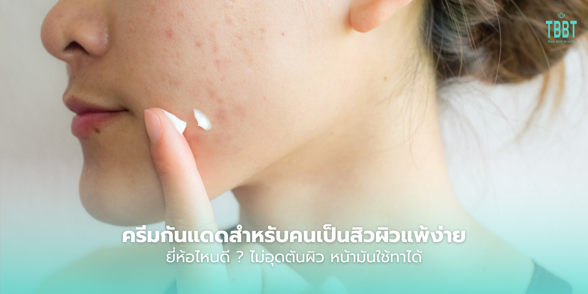 ครีมกันแดดสําหรับคนเป็นสิวผิวแพ้ง่าย ยี่ห้อไหนดี